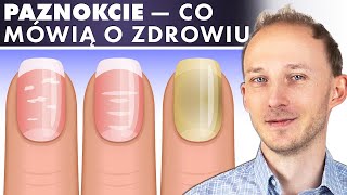 Co paznokcie mówią o Twoim zdrowiu Odczytaj choroby i niedobory z paznokci  Dr Bartek Kulczyński [upl. by Burman505]