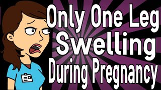 Only One Leg Swelling During Pregnancy [upl. by Arved]