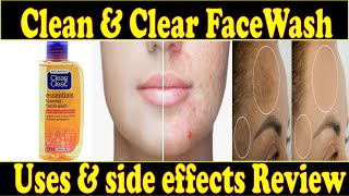 Clean amp Clear Face Wash Review😢  Uses amp Side Effects  Honest Review  Ayeshaa Naeem❤ [upl. by Zelikow316]