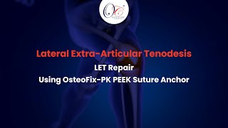 Lateral ExtraArticular Tenodesis LET Repair  OsteoFixPK PEEK Suture Anchor  Knee Arthroscopy [upl. by Danczyk]