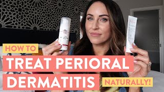 Perioral Dermatitis Treatment  Juli Bauer Roth [upl. by Anastasie351]