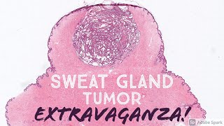 Sweat Gland Tumor Dermatopathology Board Review 31 Slides  Pathology Dermpath Dermatology [upl. by Olnee]