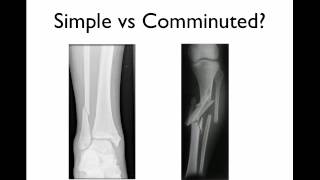 How to describe a fracture [upl. by Ji]