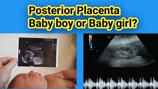 Posterior placenta Baby boy or Baby Girl Gender Prediction Radiology vibes [upl. by Attelrahs96]