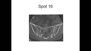 RADIOLOGY EXAM CASES [upl. by Izy]