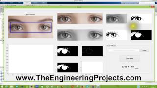 EyeBall Detection in MATLAB [upl. by Onida291]