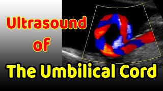 Ultrasound of the Umbilical Cord [upl. by Yves]