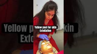 Yellow peel for akin exfoliation at Delhi  8287001211  peels peeloff skincareroutine [upl. by Heidie]