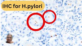 Unusual bacillary and coccoid forms of Helicobacter pylori [upl. by Johannes]