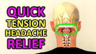 Tension Headache Exercises Stress Headache Relief in 4 Minutes [upl. by Floss]