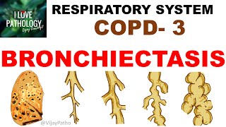 Chronic Obstructive Pulmonary Disease Part 3 Bronchiectasis  Pathology [upl. by Opportina11]