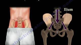 Sacroiliac Joint Dysfunction Animation  Everything You Need To Know  Dr Nabil Ebraheim MD [upl. by Ignaz830]