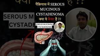 serous mucinous cystadenoma pancreas  serous mucinous cystadenoma is cancer  Pancreatic lesions [upl. by Onaicilef]