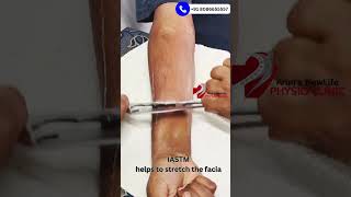 Myofascial release of forearm using IASTM Tool iastm muscle musclepain physiotherapy fascia [upl. by Laon76]