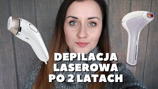 Depilacja laserowa IPL po 2 latach Czy się OPŁACA [upl. by Medorra]