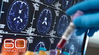 Alzheimers and Dementia  60 Minutes Full Episodes [upl. by Oloapnaig812]