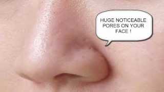 how to get rid of big pores on nose  big pores on nose [upl. by Eicnahc557]