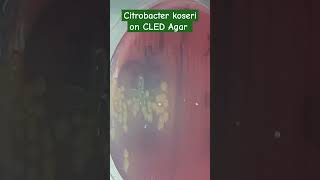 Citrobacter koseri Colony Morphology on CLED Agar of Urine Culture [upl. by Ahseret]