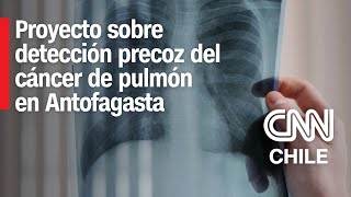 Antofagasta Nuevo proyecto busca detectar precozmente el cáncer de pulmón [upl. by Jewett880]