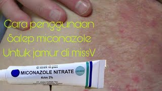 Cara penggunaan Salep miconazole untuk jamur di daerah miss V [upl. by Alica]