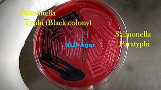 Salmonella Typhi and Salmonella Paratyphi growth on XLD agar [upl. by Delcine]