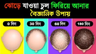 চুল ঝোড়ে যাওয়ার হাত থেকে বাচতে অবশ্যই দেখুন  How To Prevent Hair Fall Without Wasting Money [upl. by Siroved]