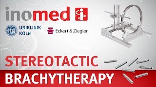 Stereotactic Brachytherapy for Brain Tumors – surgical workflow – inomed [upl. by Karlik]