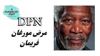 Dermatosis papulosa nigra DPN مرض الممثل مورغان فريمان تصبغات جلدية سوداء و بنية Morgan Freeman [upl. by Buatti]