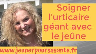 Comment Olga soigne son urticaire Géant avec le jeûne thérapeutique [upl. by Letnuahc237]