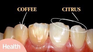 What Causes Yellow Teeth  How to Whiten Your Teeth for a Brighter Smile  Deep Dives  Health [upl. by Eterg]