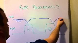 Fetal Heart Rate Decelerations Early Late Variable [upl. by Devaney]