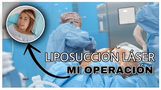 LIPOSUCCION y REMODELACIÓN 360  MI OPERACION y EXPERIENCIA Lipedema [upl. by Cuttler]