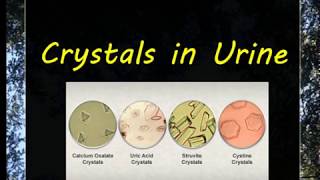 Urine Examination3 Crystals [upl. by Eizdnil]