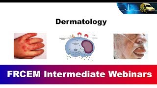 MRCEM Intermediate SBA Webinar  Dermatology [upl. by Nnairek]