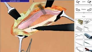 Hernia Repair  Open Surgery Simulation [upl. by Alimaj]