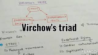 Virchows Triad  Revision seriesBasic sciences [upl. by Royo]