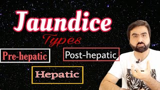 Jaundice  Types of Jaundice  Prehepatic  Hepatic  Posthepatic  UrduHindi [upl. by Shreve]