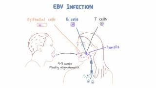 EBV and Mononucleosis  Pathogenesis and Clinical Presentation [upl. by Darra]