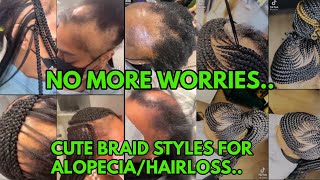 CUTE BRAID STYLES FOR WOMEN WITH ALOPECIA HAIRLOSS THIN amp DAMAGED HAIR [upl. by Annair]