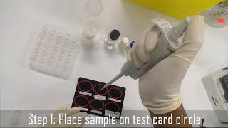 Demo Hemostasis DDimer test Copyright pending [upl. by Karl]