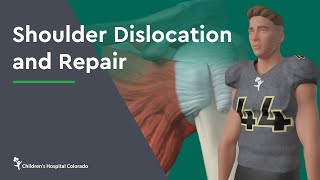 Shoulder Dislocation and Repair [upl. by Aicissej]