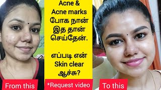 How I cleared my acne  My skincare routine for Acne amp Acne marks  Best products for pimple skin [upl. by Dihahs]