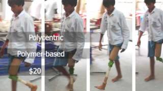 ReMotion Designs Introduction Video  The 20 JaipurKnee for Above Knee Amputees [upl. by Wheeler956]