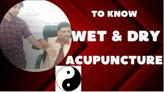 TO KNOW WET amp DRY ACUPUNCTURE [upl. by Alius]