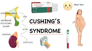 ‎⭕ شرح مفصل خطوة بخطوة لـ  Pathophysiology of Cushing’s Syndrome [upl. by Reagan]