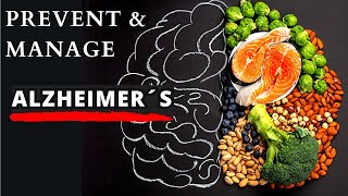 Best Diets to Prevent Dementia amp Alzheimer´s [upl. by Primalia831]