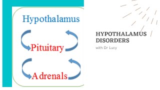 Disorders of the Hypothalamus [upl. by Hairaza96]