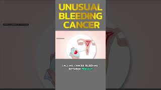 Signs and Symptoms of Unusual Bleeding Cancer [upl. by Madancy]