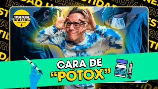 CARA DE PÓTOX  CARLOS GALDÓS EN HONESTIDADBRUTAL [upl. by Tanitansy]