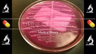 Urine Culture Growth Plates [upl. by Ottavia]